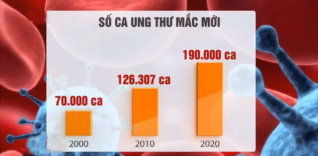 tai sao ung thu ngay mot gia tang