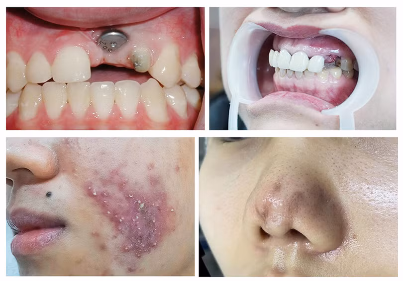 Sức khỏe và sắc đẹp - như thế nào là rẻ?