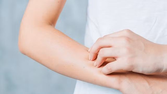 Dị ứng thời tiết gây ra cảm giác khó chịu cho người bệnh.