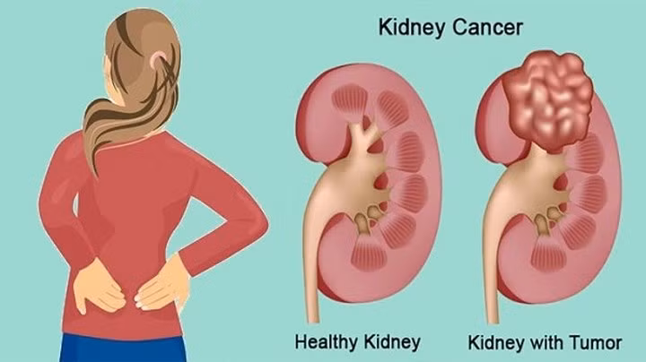 Hậu quả khôn lường khi nhịn ăn để giảm cân