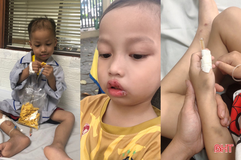 Sau chuỗi ngày điều trị hóa chất, Hoàng Phúc xuất hiện nhiều vết lở, thâm sạm, cơ thể gầy gò. z5558253334839_c4445300569c1ec0e92d035b23cdaba0.jpg