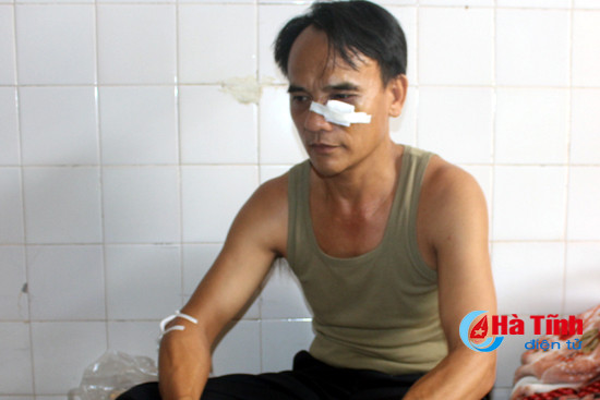 vo co danh hang xom vo mui phai nhap vien dieu tri