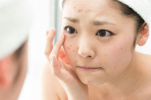 Khắc phục phản ứng do da nhạy cảm