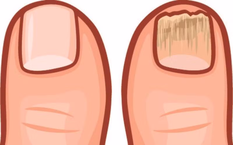 9 dấu hiệu cho thấy cơ thể bạn đang chứa nhiều độc tố