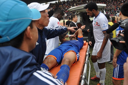 Tiền đạo Alaan Bruno của Than Quảng Ninh bị gãy xương mác và gần như chắc chắn sẽ phải nghỉ thi đấu phần còn lại của mùa giải 2014