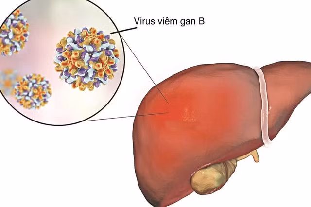 5 lầm tưởng của bạn có thể gây hại gan