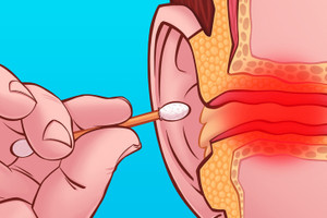 Những sai lầm khi vệ sinh cơ thể