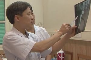 Bệnh viện Việt Đức lần đầu thay lại khớp gối nhân tạo