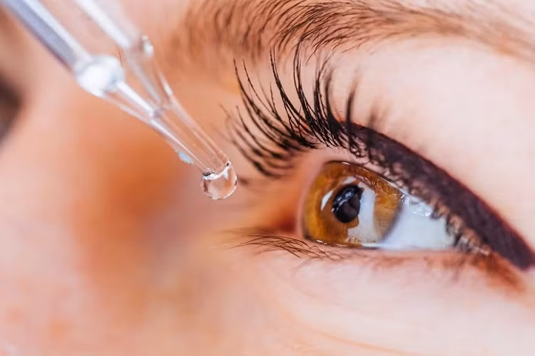 Mù một bên mắt vì dùng thuốc nhỏ mắt kéo dài