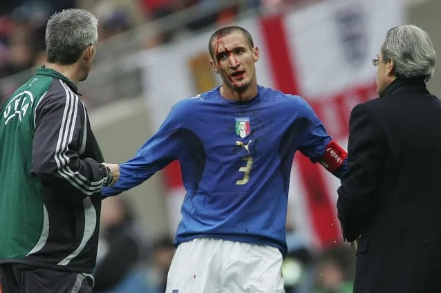 Nhận định Anh vs Ý: Chiellini đã sẵn sàng cho trận chiến cuối