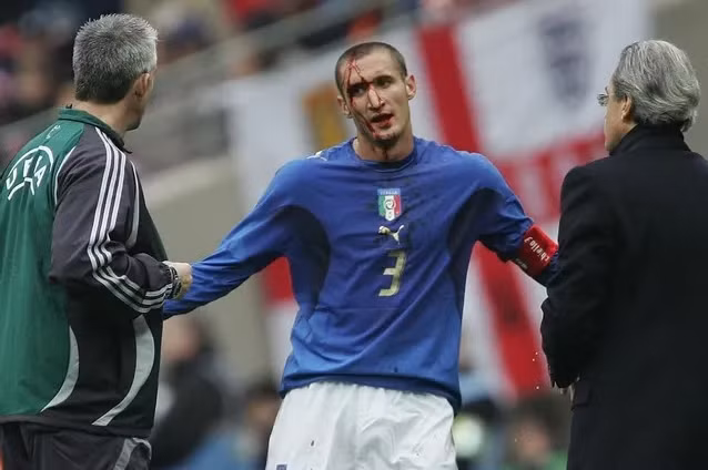 Nhận định Anh vs Ý: Chiellini đã sẵn sàng cho trận chiến cuối