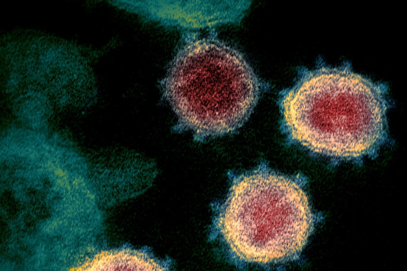 Ca mắc hiếm gặp khi nhiễm cùng lúc 2 biến thể của virus SARS-CoV-2