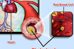 Kẻ thù âm thầm đang giết chết nhiều người trẻ tuổi