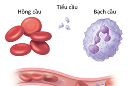 Thiếu máu và những hệ lụy khó lường