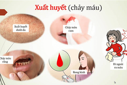 Bác sĩ chỉ rõ 2 biến chứng nguy hiểm của sốt xuất huyết