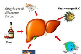 7 biện pháp tự nhiên để giảm men gan