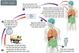 Xét nghiệm sán lợn - hiểu thế nào cho đúng?