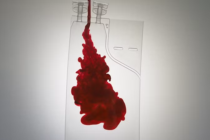 Huyết tương của người khỏi bệnh có thể diệt nCoV