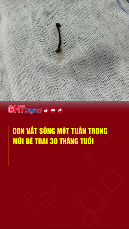 Con vắt sống một tuần trong mũi bé trai 30 tháng tuổi