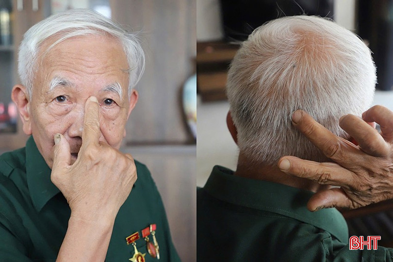 Trong kháng chiến chống Mỹ cứu nước, ông Phan Văn Đại bị trúng đạn vào vị trí đặc biệt nguy hiểm ở vùng đầu, không thể can thiệp. bqbht_br_z6534273221177-316fe0a227ed6680735c87d061f847b7.jpg