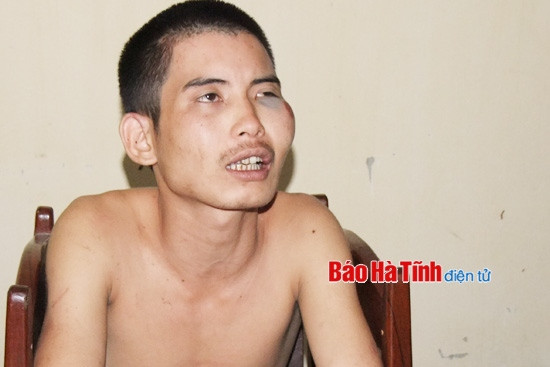 "Ngáo đá", quậy phá bệnh viện rồi đâm chí mạng bạn nhậu ảnh 2