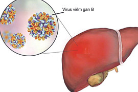 Cảnh giác với suy gan cấp