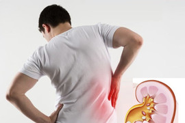 Người bị sỏi tiết niệu nên ăn gì?