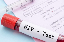 Brazil: 6 người nhiễm HIV sau khi cấy ghép tạng