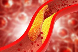 7 loại thực phẩm giúp giảm mỡ máu