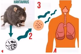 Bộ Y tế cảnh báo khẩn loại virus lây truyền từ chuột