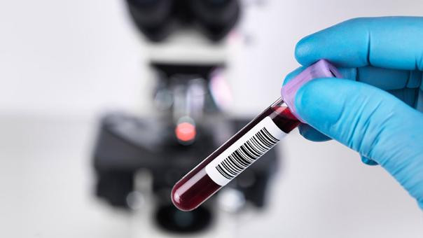 Có cần làm xét nghiệm kháng thể sau tiêm 2 mũi vaccine COVID-19?