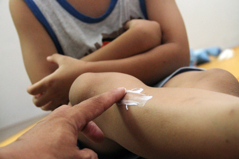 Sử dụng thuốc chống muỗi, côn trùng: Dùng sai, rước độc vào người ảnh 2 su dung thuoc chong muoi con trung dung sai ruoc doc vao nguoi