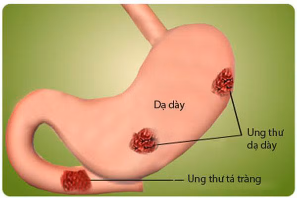 dua muoi loi hai the nao