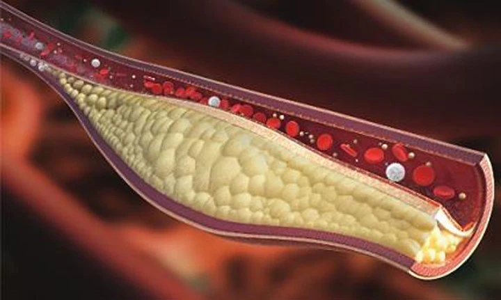 nhung nguoi tuyet doi khong duoc an lac