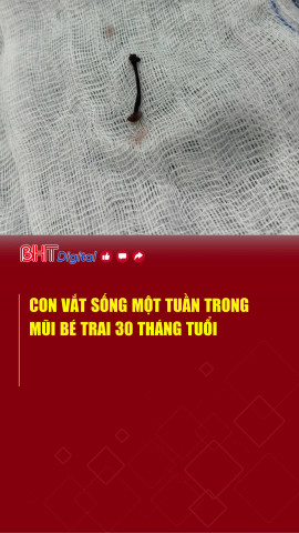 Con vắt sống một tuần trong mũi bé trai 30 tháng tuổi