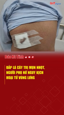 Đắp lá cây trị mụn nhọt, người phụ nữ nguy kịch hoại tử vùng lưng