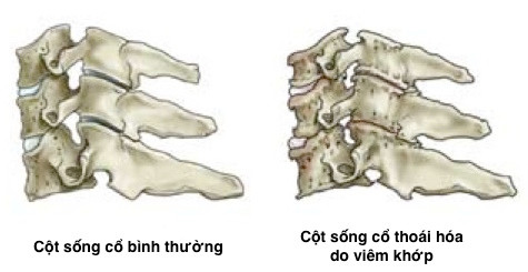 dau co man tinh cac nguyen nhan pho bien