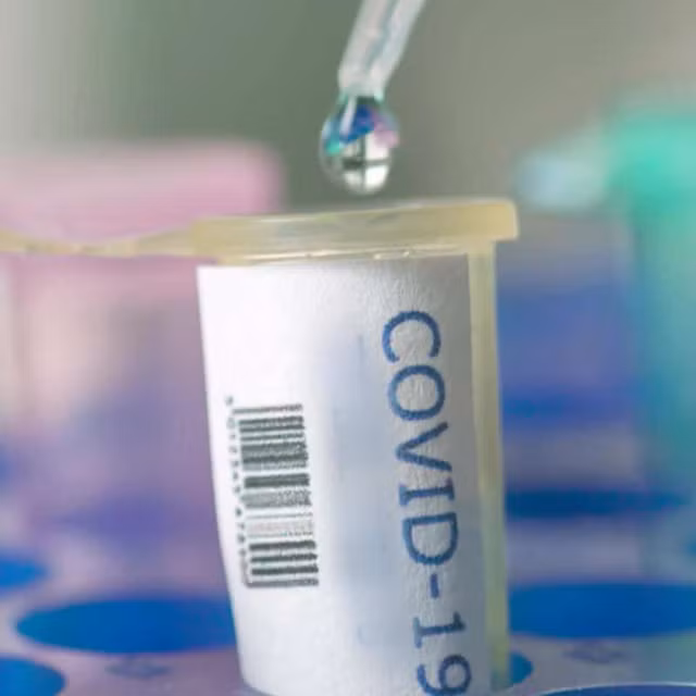 Cuộc chạy đua vắc xin Covid-19, sẽ ra mắt sớm nhất vào đầu 2021?