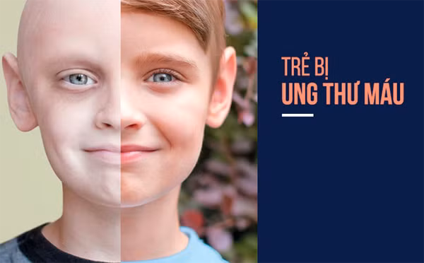 14 dau hieu canh bao ung thu som o tre em