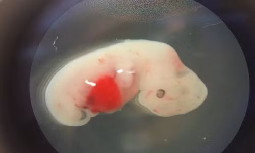 my tao thanh cong phoi thai loai lai cuu nguoi