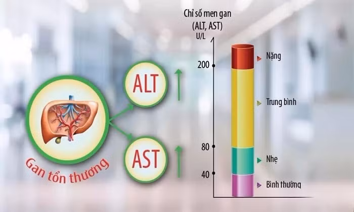 Nguyên nhân gây men gan cao, làm gì để hạ?