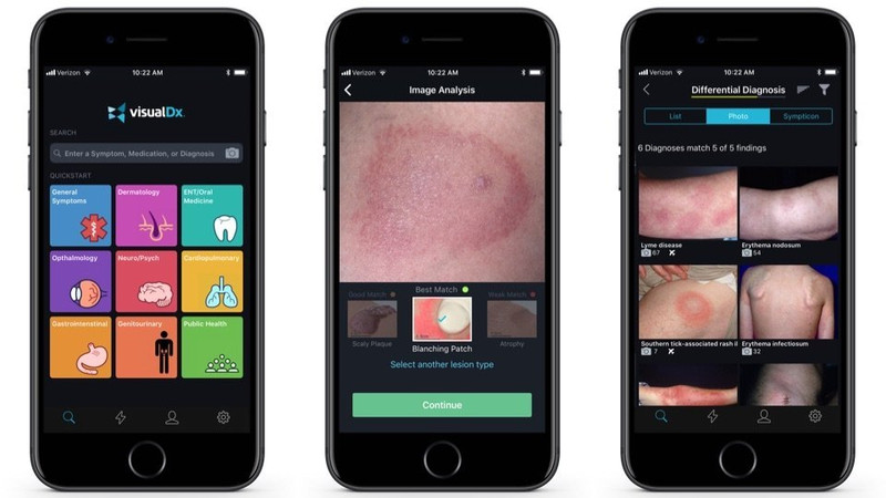 apple ra doi ung dung gia 100 usd phat hien benh da lieu qua anh chup