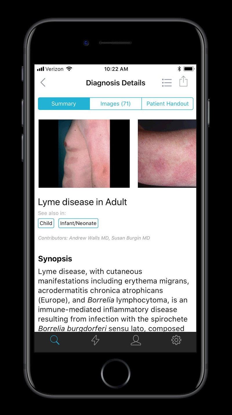 apple ra doi ung dung gia 100 usd phat hien benh da lieu qua anh chup