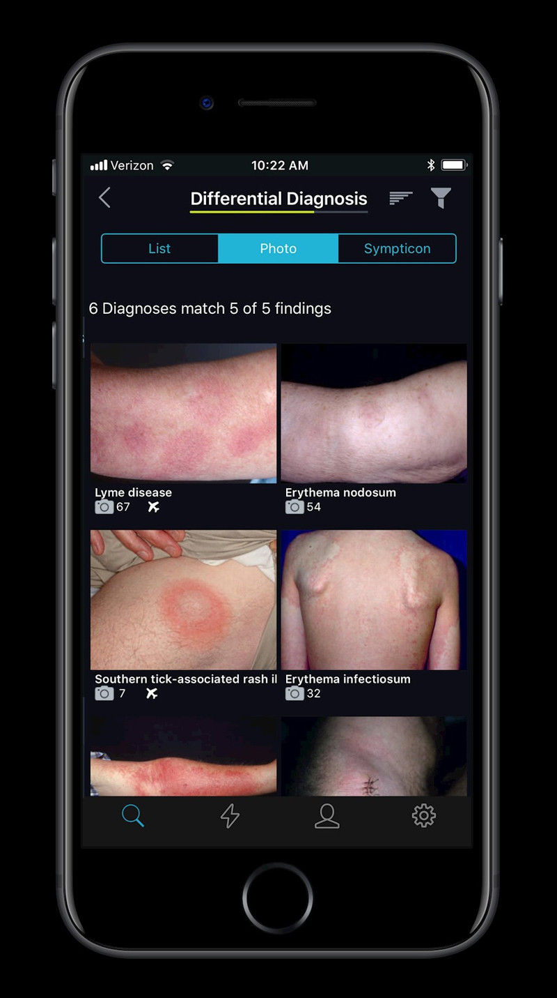 apple ra doi ung dung gia 100 usd phat hien benh da lieu qua anh chup