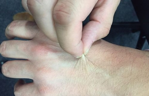 mach ban cach tu kiem tra muc do lao hoa cua da cuc de