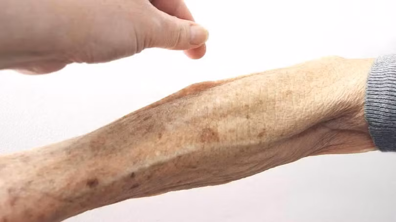 Chỉ với 3 giây, bạn có thể kiểm tra mình có đang bị mất nước hay không