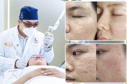 5 lý do đưa Phòng khám Da liễu LG luôn thuộc top đầu địa chỉ điều trị sẹo rỗ tại TP Hồ Chí Minh