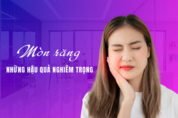 Mòn răng và những hậu quả nghiêm trọng