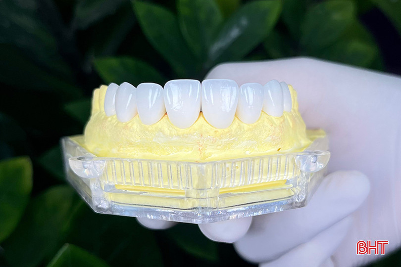Răng sứ thẩm mỹ có ưu điểm là dáng răng đều, đẹp, màu sắc tự nhiên, an toàn, khả năng ăn nhai như răng thật. mai hung 4.jpg