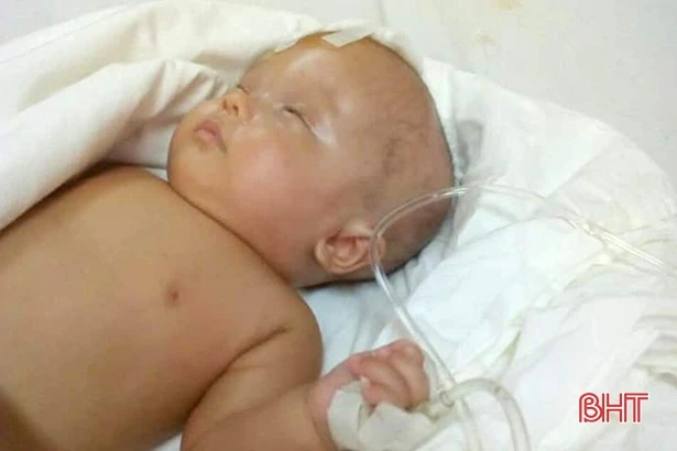 Bố mẹ bất lực nhìn con song sinh vật vã bởi căn bệnh não úng thủy